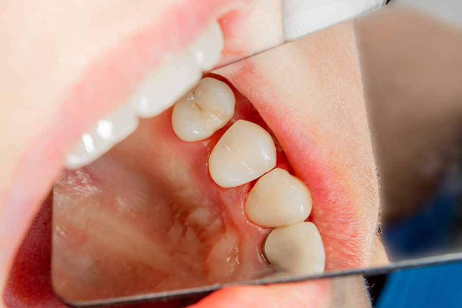 Dental Health Dental Health